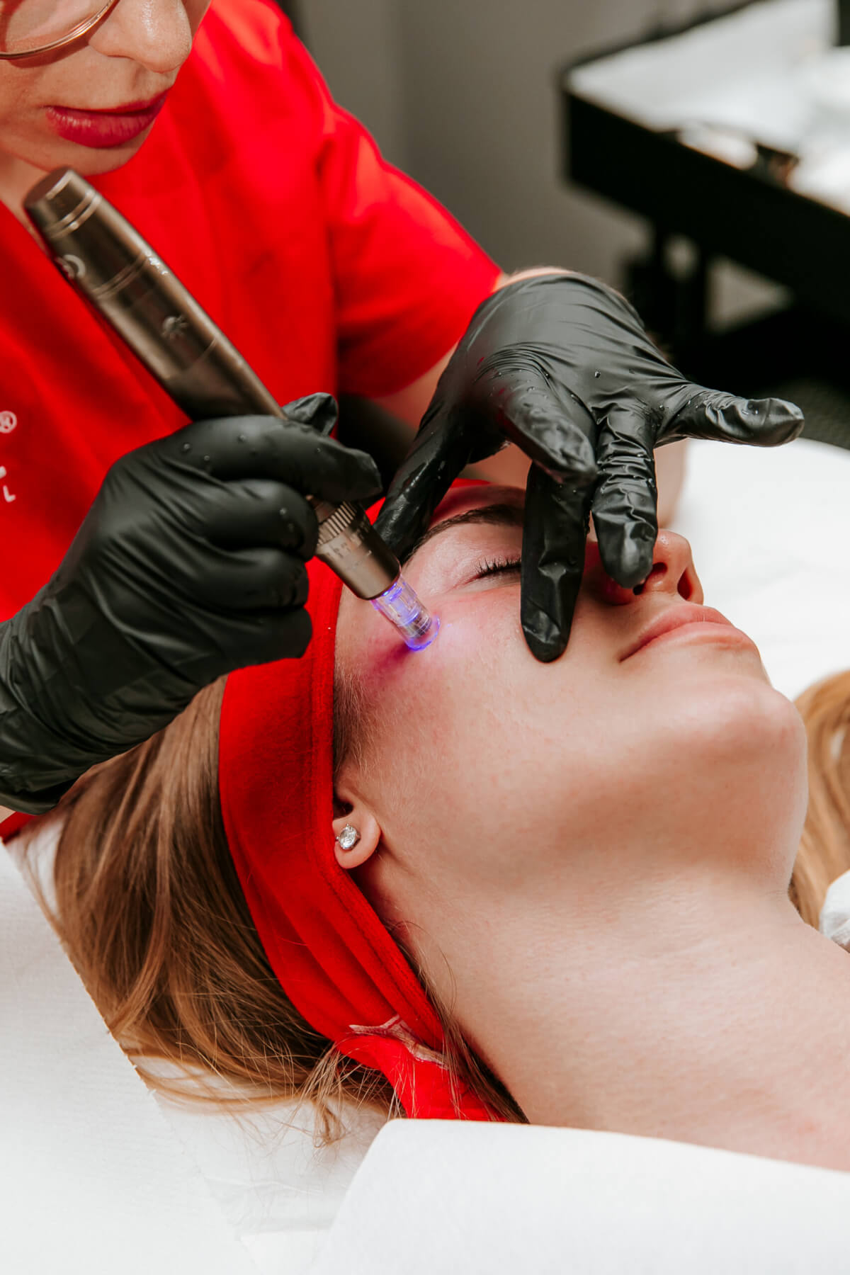 Thérapie Retix.C microneedling
