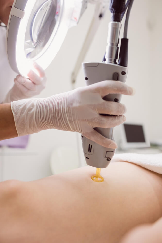 Docteur Marine HITIER - épilation définitive au laser à Annecy