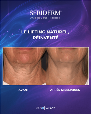 B&A 3